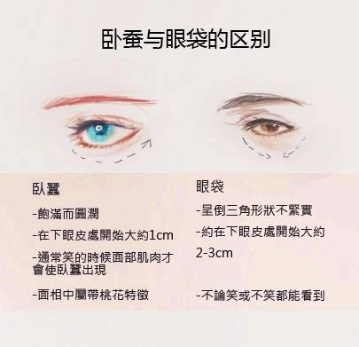 卧蚕眼