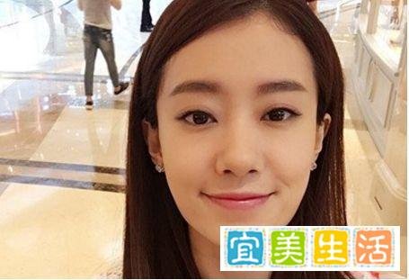 张小斐:出道15年5次上春晚,首演电影女主金鸡奖封后,幸好当年没整容
