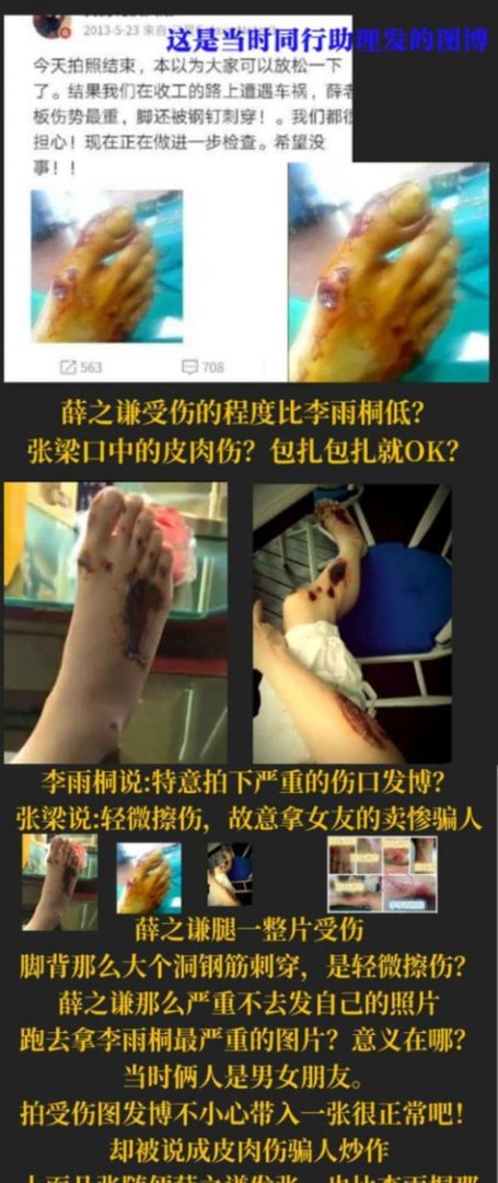 薛之谦车祸真相