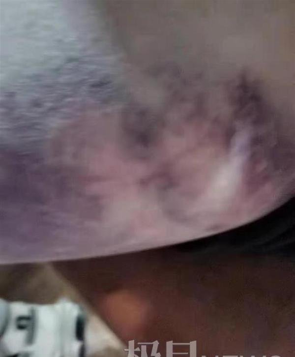 暴力夏令营!河北三少年被殴打至吐血,写纸条求救,施暴校长行拘15天