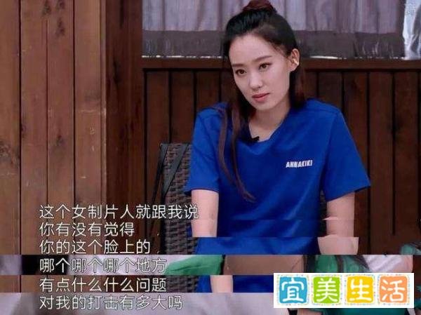 张小斐:出道15年5次上春晚,首演电影女主金鸡奖封后,幸好当年没整容