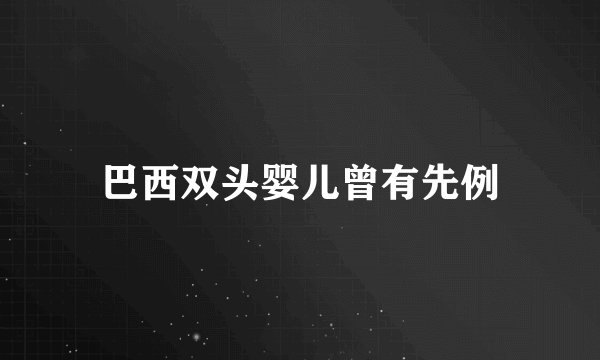 巴西双头婴儿曾有先例