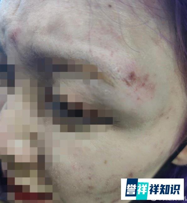 济南公安局：成源行为构成殴打他人，行政处罚拘留十日处罚款五百