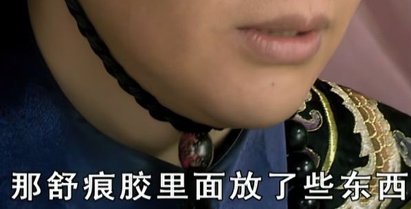 甄嬛传舒痕胶在哪一集被发现的