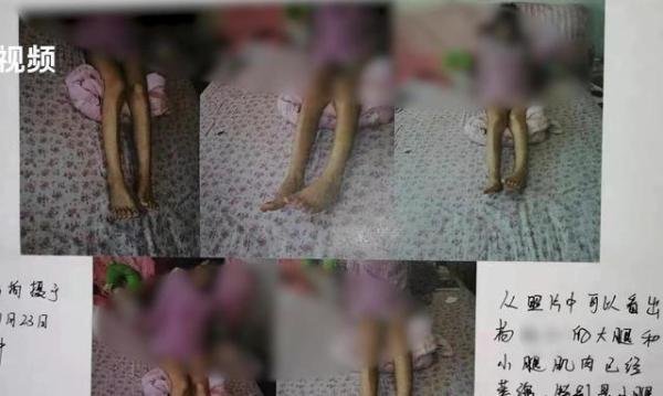 山东女子控诉因生女孩遭家暴后瘫痪 法院二审责令警方重查