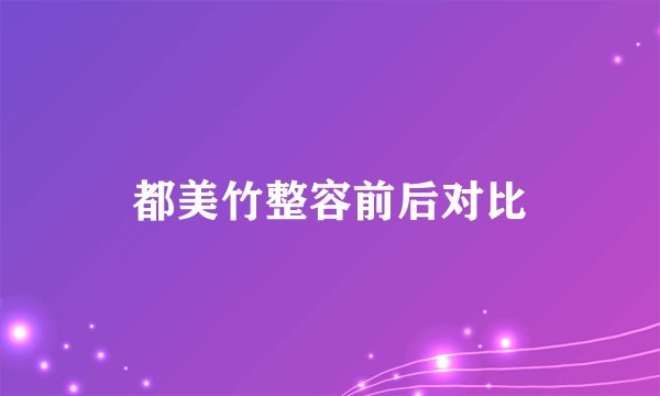 都美竹整容前后对比