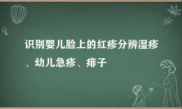 识别婴儿脸上的红疹分辨湿疹、幼儿急疹、痱子