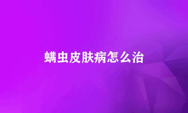 螨虫皮肤病怎么治