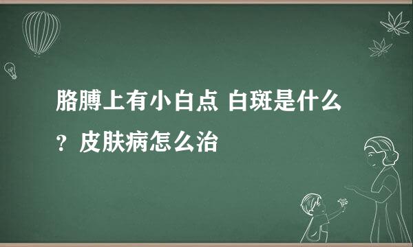 胳膊上有小白点 白斑是什么？皮肤病怎么治