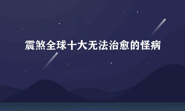 震煞全球十大无法治愈的怪病